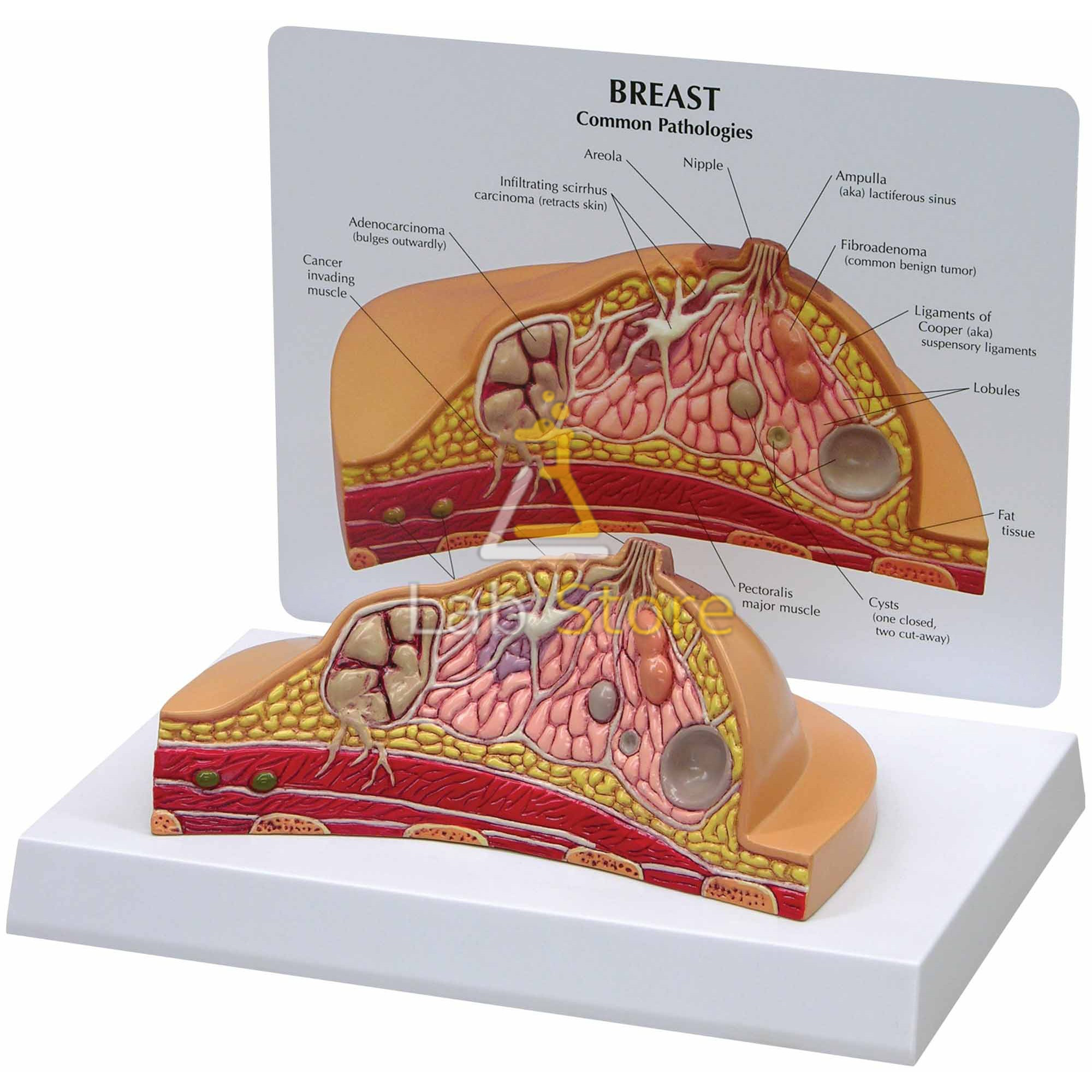 Breast Anatomy Model